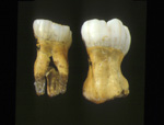 pontteeth image